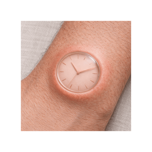 Embedded Wristwatch